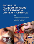 Abordajes Neuroquirúrgicos De La Patología Craneal Y Cerebral