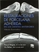 Restauraciones de Porcelana Adherida en los Dientes Anteriores: Un Enfoque Biomimético
