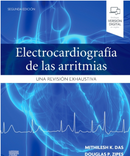 Electrocardiografía de las arritmias Una revisión exhaustiva 2nd Edition